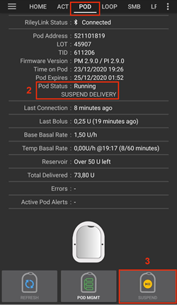 Suspend_Insulin_Delivery_2
